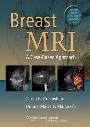 Cover of the book Breast MRI by Aída Lugo-Somolinos