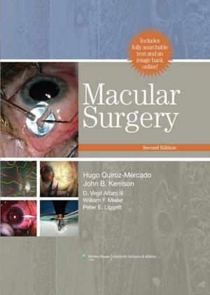 Cover of the book Macular Surgery by Sudha R. Kini