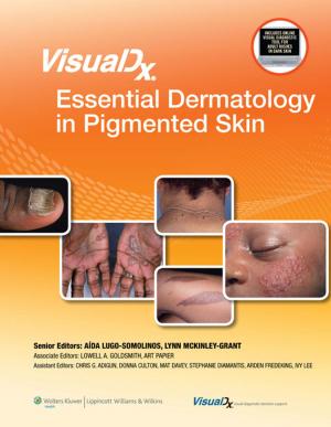 bigCover of the book VisualDx: Essential Dermatology in Pigmented Skin by 