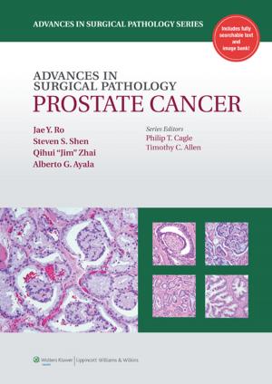 Cover of the book H27Advances in Surgical Pathology: Prostate Cancer by Dennis W. Boulware, Gustavo R. Heudebert