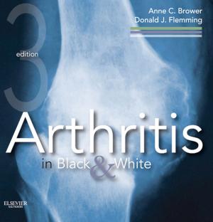 Cover of the book Arthritis in Black and White by Julia McMillan, MD, Carlton K. Lee, PharmD, MPH, George K. Siberry, MD, MHP, Karen Carroll, MD