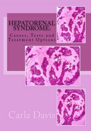 Cover of the book Hepatorenal Syndrome: Causes, Tests, and Treatment Options by Michelle Gabata, M.D.