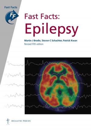 Book cover of Fast Facts: Epilepsy