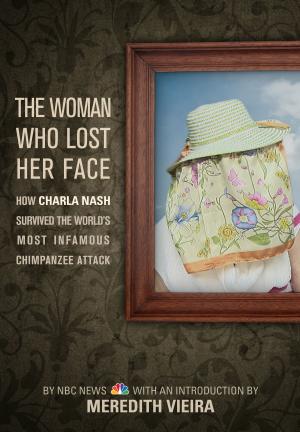 Cover of The Woman Who Lost Her Face: How Charla Nash Survived the World's Most Infamous Chimpanzee Attack