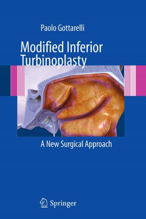 Cover of the book Modified Inferior Turbinoplasty by Rocco Chirivì, Ilaria Del Corso, Roberto Dvornicich