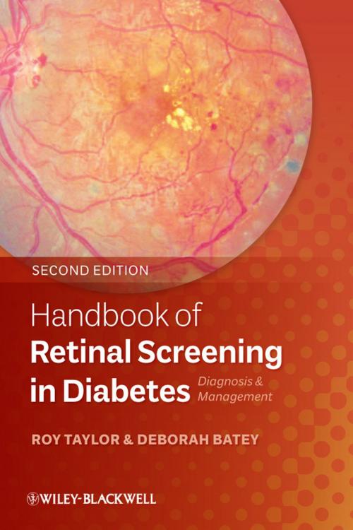 Cover of the book Handbook of Retinal Screening in Diabetes by , Wiley