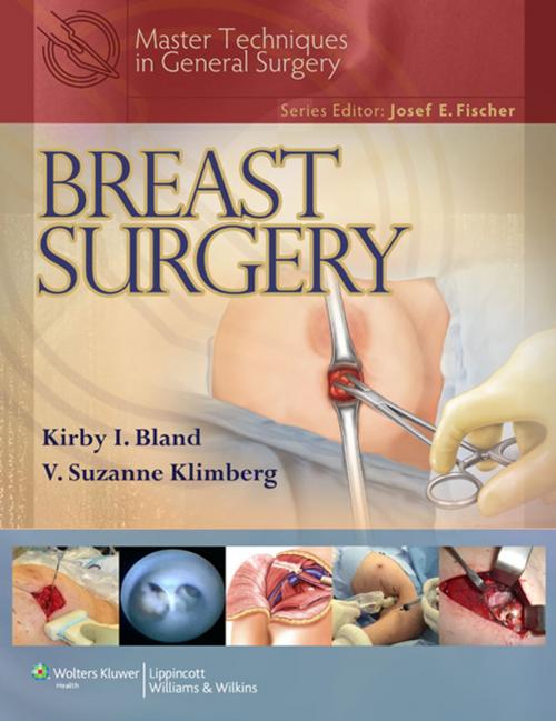 Cover of the book Master Techniques in General Surgery: Breast Surgery by Kirby I. Bland, V. Suzanne Klimberg, Wolters Kluwer Health
