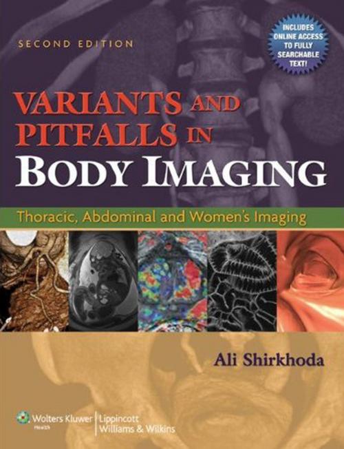 Cover of the book Variants and Pitfalls in Body Imaging by Ali Shirkhoda, Wolters Kluwer Health
