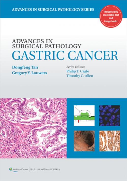 Cover of the book Advances in Surgical Pathology: Gastric Cancer by Dongfeng Tan, Gregory Lauwers, Wolters Kluwer Health