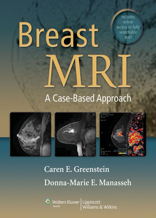 Cover of the book Breast MRI by Caren Greenstein, Wolters Kluwer Health