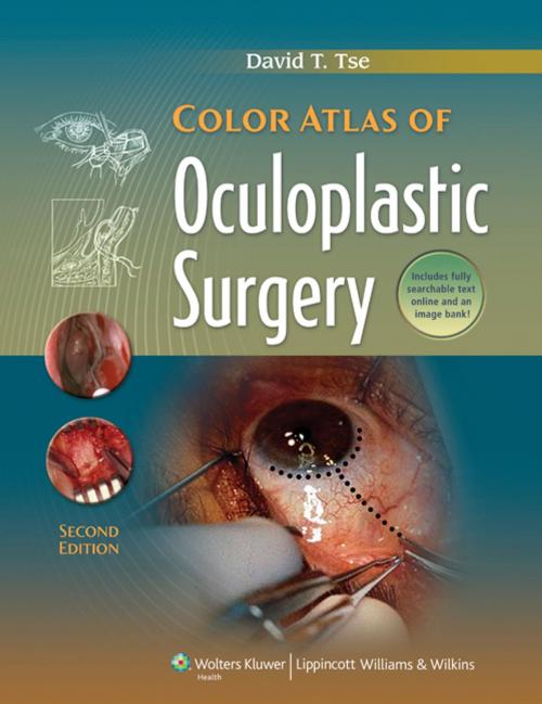 Cover of the book Color Atlas of Oculoplastic Surgery by David T. Tse, Wolters Kluwer Health