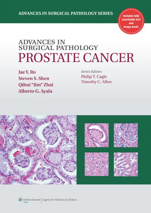 Cover of the book H27Advances in Surgical Pathology: Prostate Cancer by Jae Y. Ro, Alberto G. Ayala, Steven S. Shen, Wolters Kluwer Health