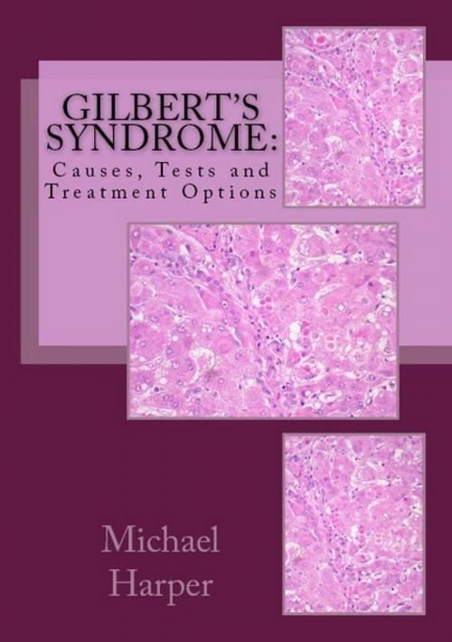 Cover of the book Gilbert's Syndrome: Causes, Tests and Treatment Options by Michael Harper, Andale LLC