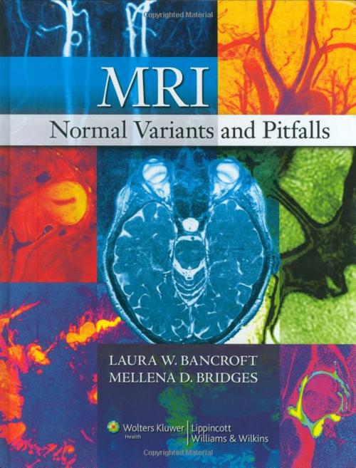 Cover of the book MRI Normal Variants and Pitfalls by Laura W. Bancroft, Mellena D. Bridges, Wolters Kluwer Health