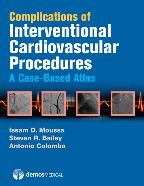 Cover of the book Complications of Interventional Cardiovascular Procedures by Steven R. Bailey, MD, Antonio Colombo, MD, Issam D. Moussa, MD, Springer Publishing Company