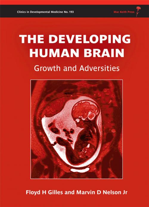 Cover of the book The Developing Human Brain: Growth and Adversities by Floyd Harry Gilles, Marvin D. Nelson, Mac Keith Press