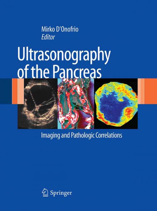 Cover of the book Ultrasonography of the Pancreas by , Springer Milan