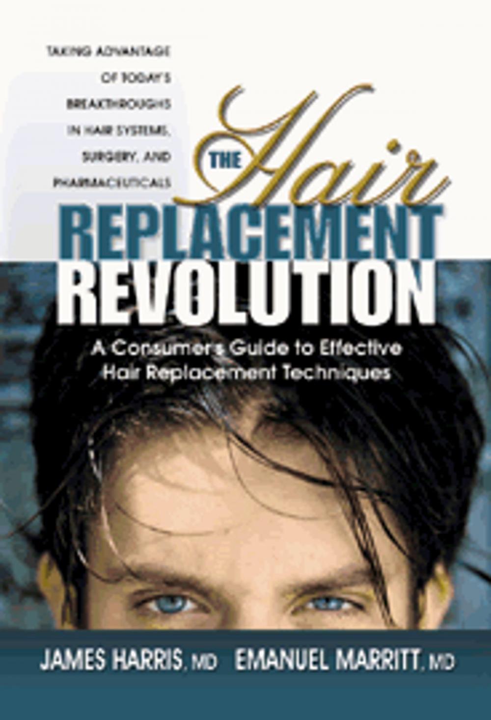 Big bigCover of The Hair Replacement Revolution