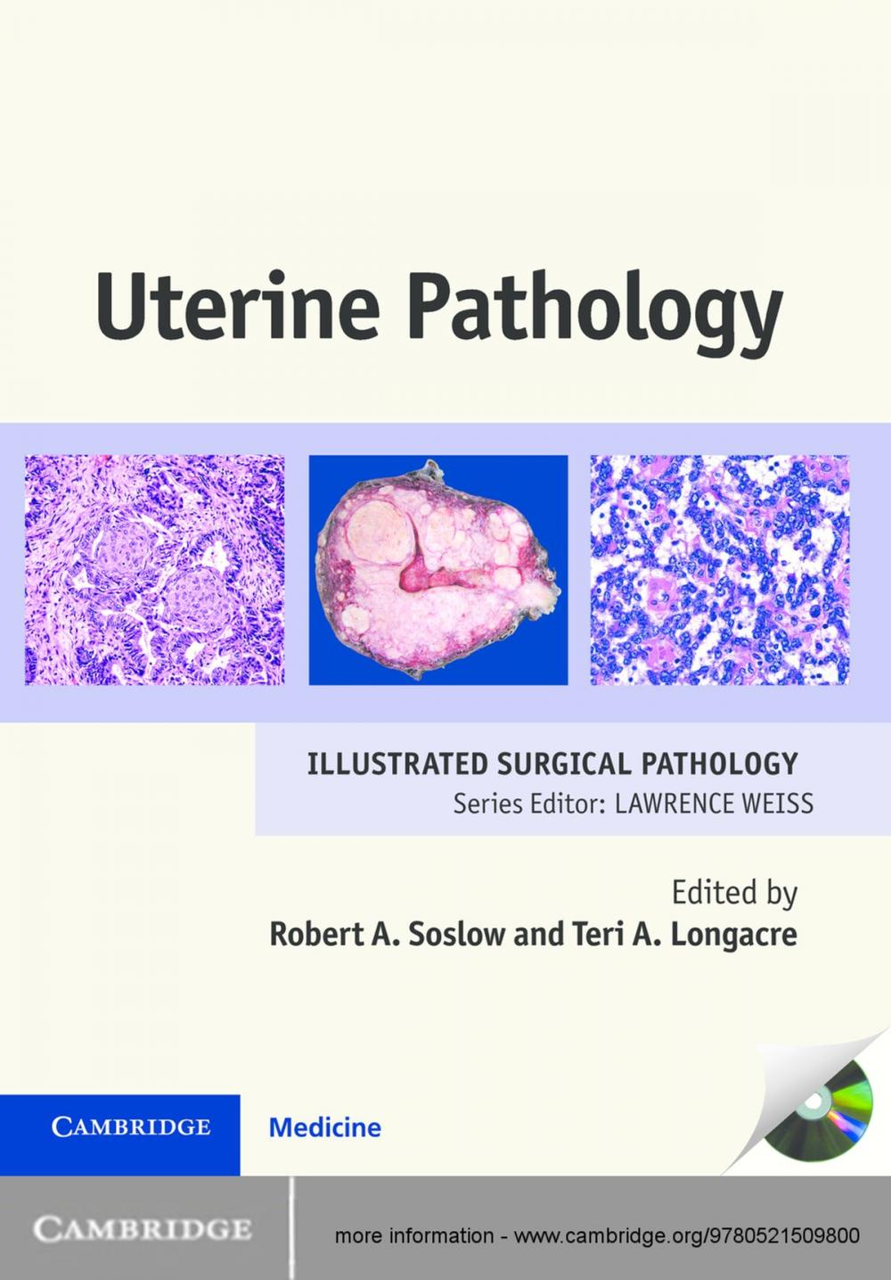 Big bigCover of Uterine Pathology