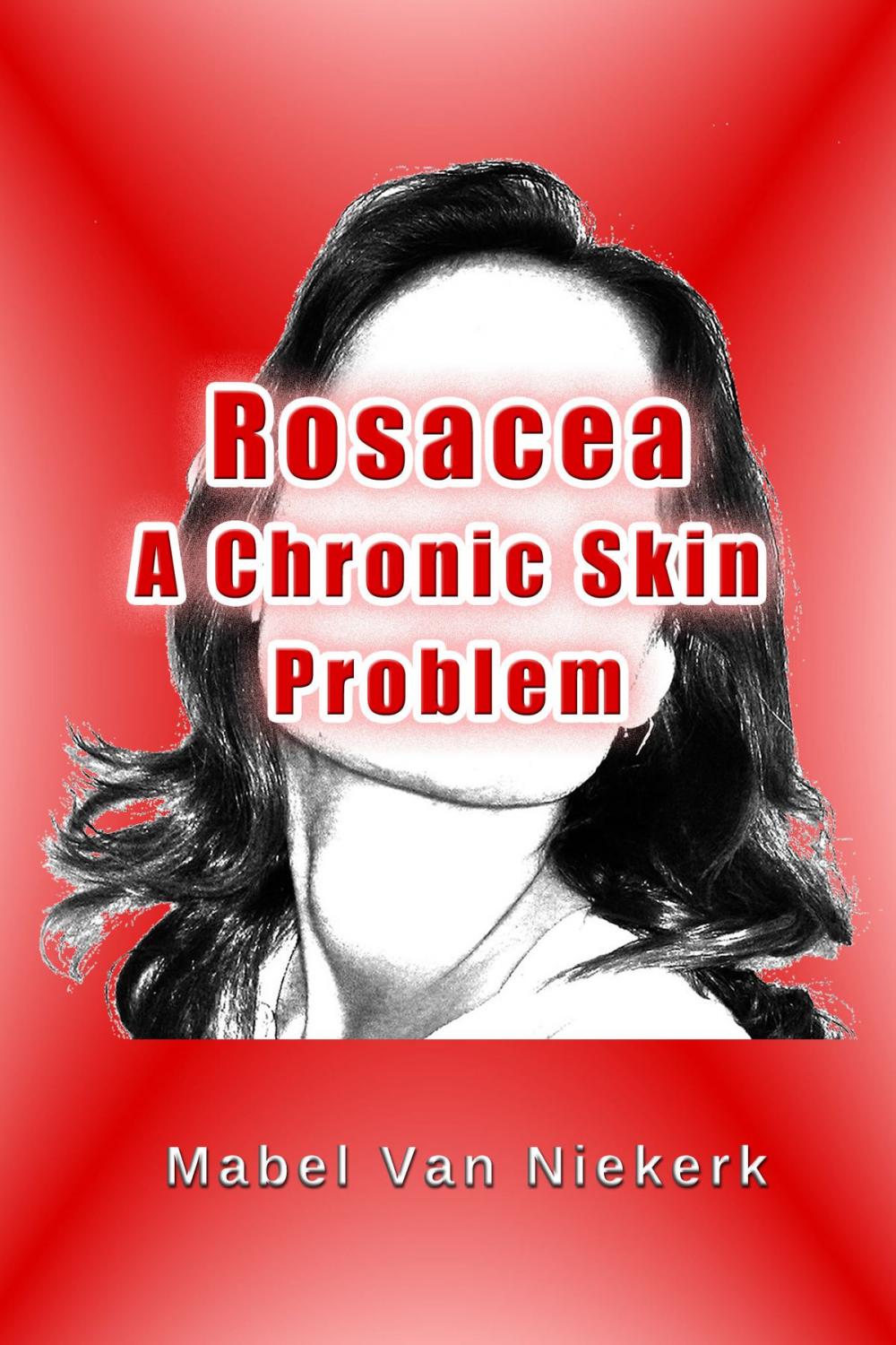 Big bigCover of Rosacea: A Chronic Skin Problem