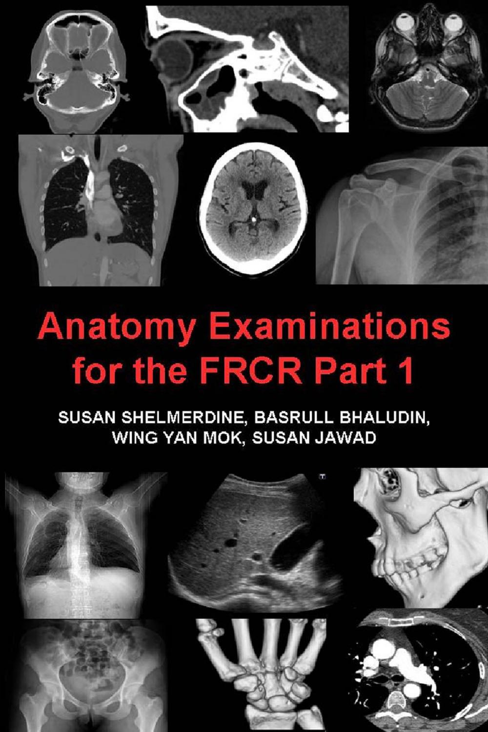 Big bigCover of Anatomy Examinations for the FRCR Part 1