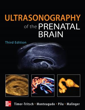 Book cover of Ultrasonography of the Prenatal Brain, Third Edition