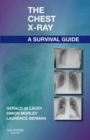 Cover of the book The Chest X-Ray: A Survival Guide E-Book by Stephen A. Schendel, MD, DDS, FACS