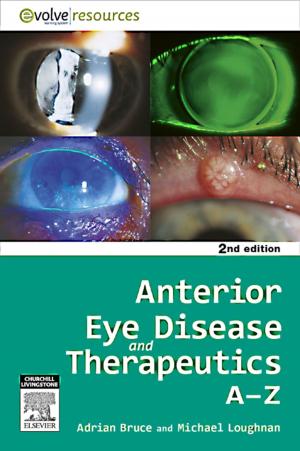 Cover of the book Anterior Eye Disease and Therapeutics A-Z by Alon Y. Avidan, MD, MPH, Teri J. Barkoukis, MD