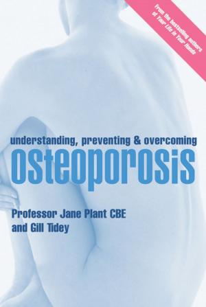 Book cover of Understanding, Preventing and Overcoming Osteoporosis