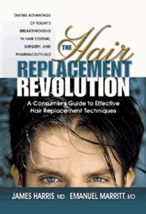 Cover of the book The Hair Replacement Revolution by Nancy Appleton