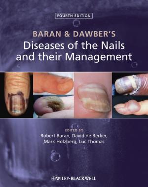 Cover of the book Baran and Dawber's Diseases of the Nails and their Management by Fred Hassan
