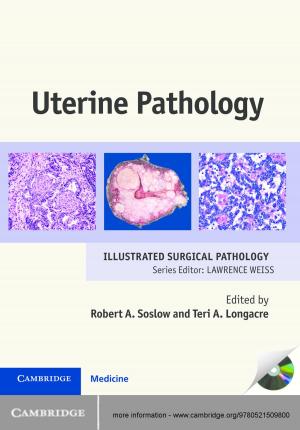 Book cover of Uterine Pathology
