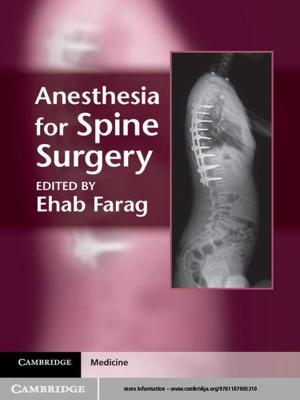 Cover of the book Anesthesia for Spine Surgery by 