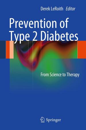 Cover of the book Prevention of Type 2 Diabetes by George L. Lucas, Elizabeth Friis, Francis W. Cooke