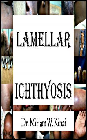 Book cover of Lamellar Ichthyosis
