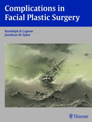 Cover of the book Complications in Facial Plastic Surgery by Michael Schuenke, Erik Schulte, Udo Schumacher