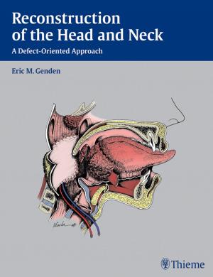 Book cover of Reconstruction of the Head and Neck