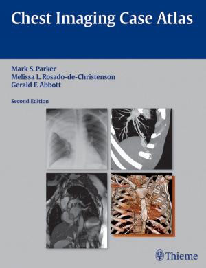 Book cover of Chest Imaging Case Atlas