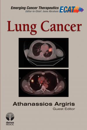 Cover of the book Lung Cancer by Peter Lehmann, PhD, LCSW, Dr. Catherine Simmons, PhD