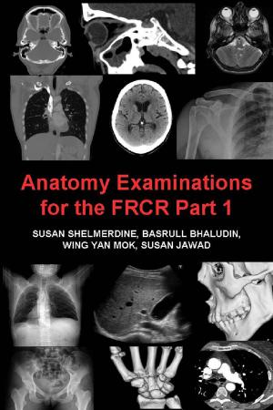 Cover of the book Anatomy Examinations for the FRCR Part 1 by Andy Groom