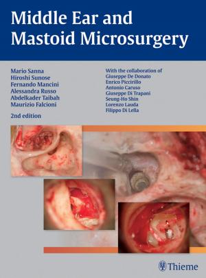 Cover of the book Middle Ear and Mastoid Microsurgery by Andrea Baur-Melnyk, Maximilian F. Reiser