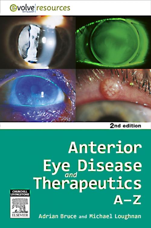 Cover of the book Anterior Eye Disease and Therapeutics A-Z by Adrian S. Bruce, Michael Stephen Loughnan, Elsevier Health Sciences APAC