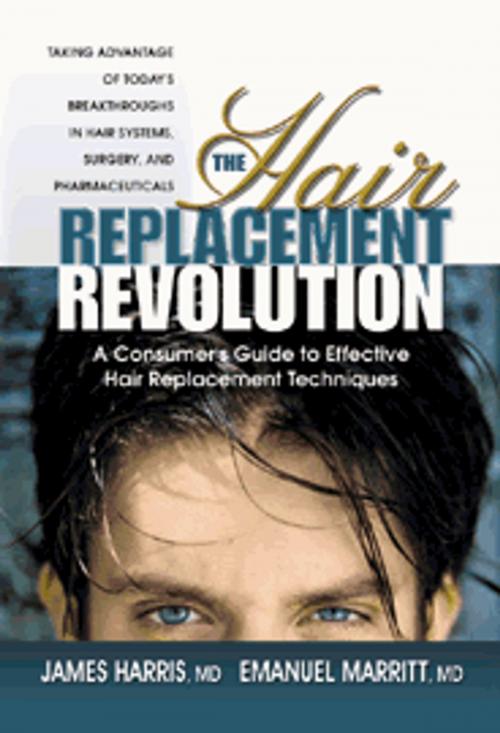 Cover of the book The Hair Replacement Revolution by James Harris, Emanuel Marritt, Square One Publishers