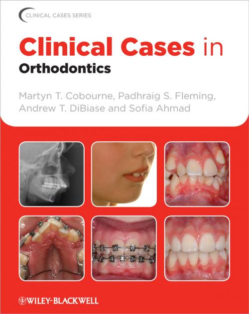 Cover of the book Clinical Cases in Orthodontics by Martyn T. Cobourne, Padhraig S. Fleming, Andrew T. DiBiase, Sofia Ahmad, Wiley