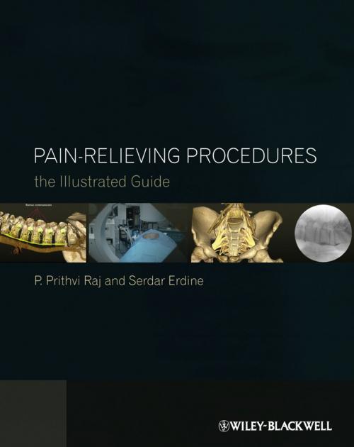 Cover of the book Pain-Relieving Procedures by P. Prithvi Raj, Serdar Erdine, Wiley