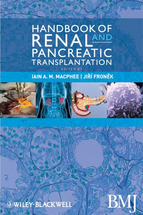 Cover of the book Handbook of Renal and Pancreatic Transplantation, Enhanced Edition by , Wiley