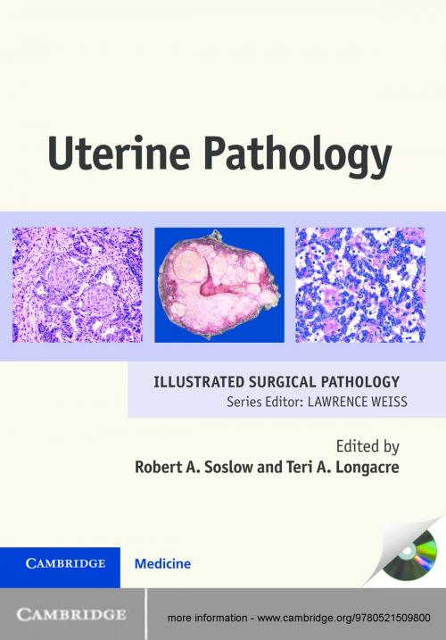 Cover of the book Uterine Pathology by Robert A. Soslow, MD, Teri A. Longacre, MD, Cambridge University Press