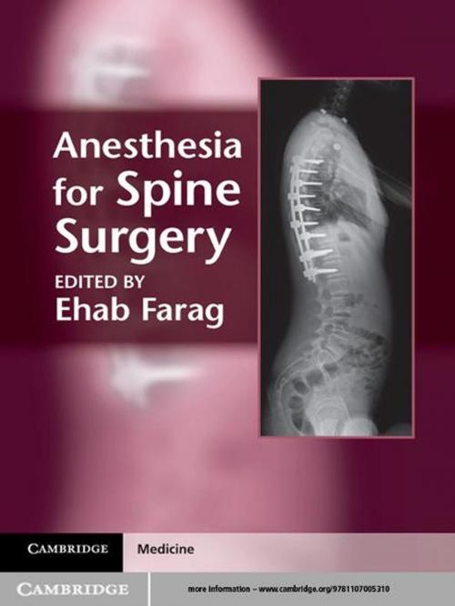 Cover of the book Anesthesia for Spine Surgery by , Cambridge University Press