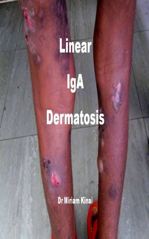 Cover of the book Linear IgA Dermatosis by Miriam Kinai, Miriam Kinai
