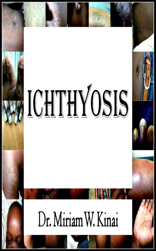 Cover of the book Ichthyosis by Miriam Kinai, Miriam Kinai